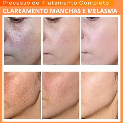 Kit de skincare com vitamina C - foto 2