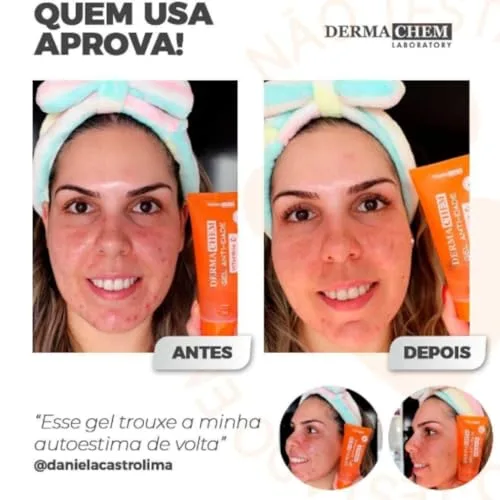 Kit de skincare com vitamina C - foto 2
