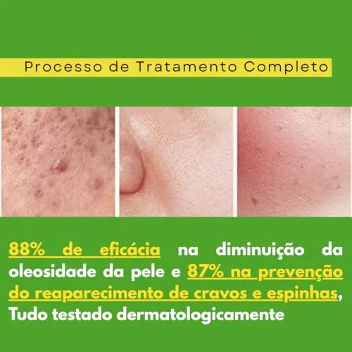Kit de skincare para pele oleosa - foto 5