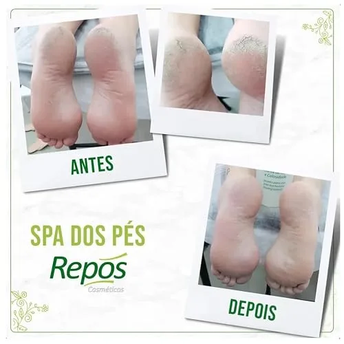 Kit de cuidado com os pés - foto 3
